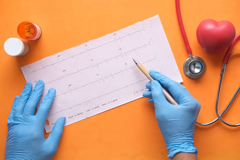 Capacitação em Eletrocardiograma